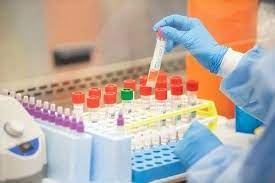 توزیع 59 هزار رپید تست در میان مراکز خدمات جامع سلامت ویژه کرونا