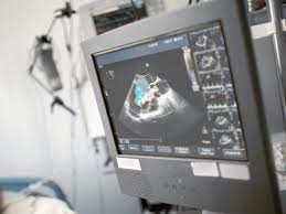 یک دستگاه اکوکاردیوگرافی پیشرفته به دانشگاه علوم پزشکی مشهد اختصاص یافت