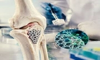 پویش همگانی پوکی استخوان در خراسان رضوی؛ «استخوان‌های محکم بسازیم و از آنها محافظت کنیم»