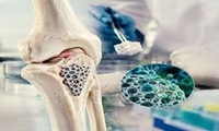 آغاز پویش همگانی پوکی استخوان با شعار «استخوان‌های محکم بسازیم و از آنها محافظت کنیم»