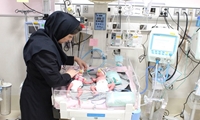 پنجمین عمل سزارین مادر ۴۷ ساله با سابقه چهار سزارین پیشین