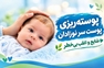 پوسته‌ریزی پوست سر نوزادان؛ عارضه‌ای شایع که اغلب بدون درمان برطرف می‌شود