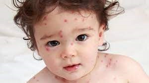 562.jpg - 11.34 kb