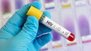 شناسایی به موقع افراد مبتلا به hiv زمینه درمان و عدم تبدیل آن به ایدز را فراهم می کند