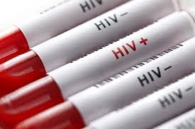 انجام 7 هزار تستhiv و شناسایی هفت مورد جدید