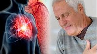ابتلا به ویروس کووید-19، علائم بیماری قلبی و عروقی را تشدید می کند